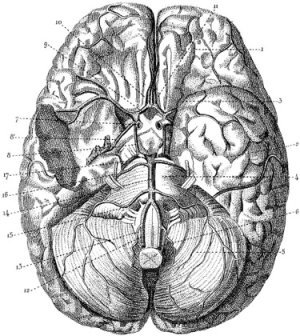 cerebrovascular disease