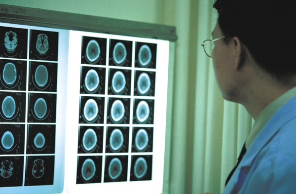 neurological evaluation